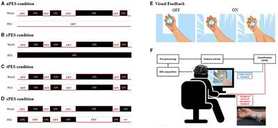 Attentional state-synchronous peripheral electrical stimulation during action observation induced distinct modulation of corticospinal plasticity after stroke